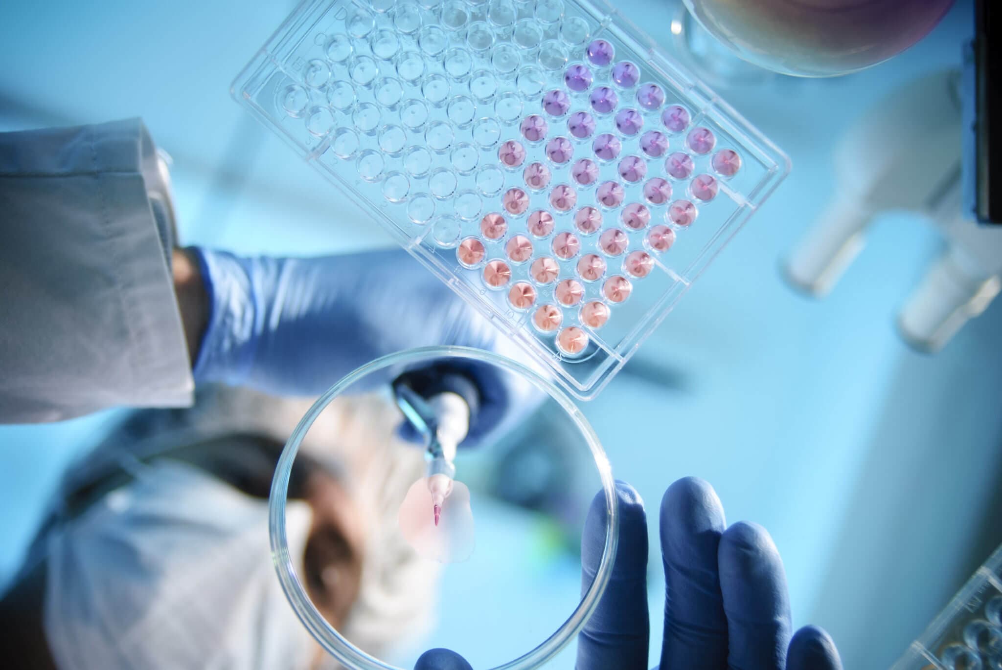 Real photo of a clinical research coordinator working with structured study data on screen, focused and precise.